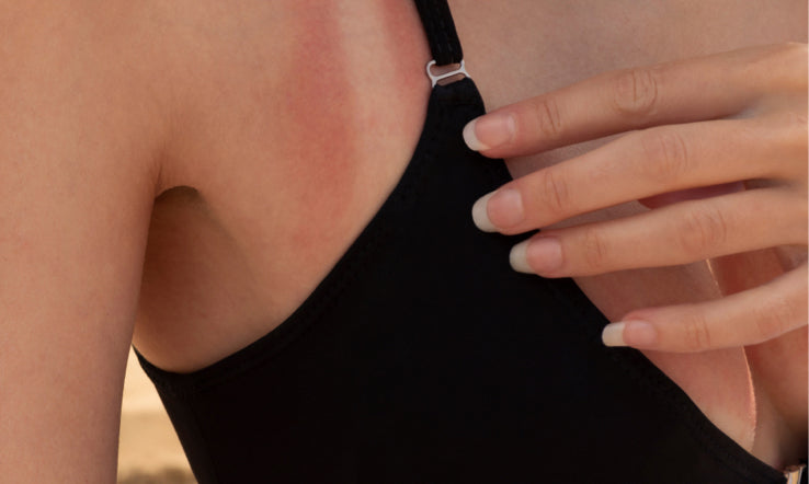 The Art of Skin Preservation: Mastering Sun Damage Restoration