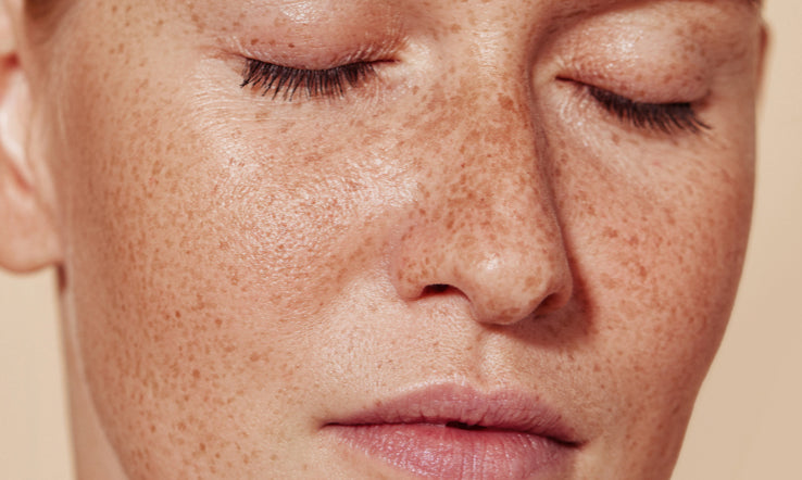 Unlocking the Hidden Beauty: The Power of Skin's Microbiome