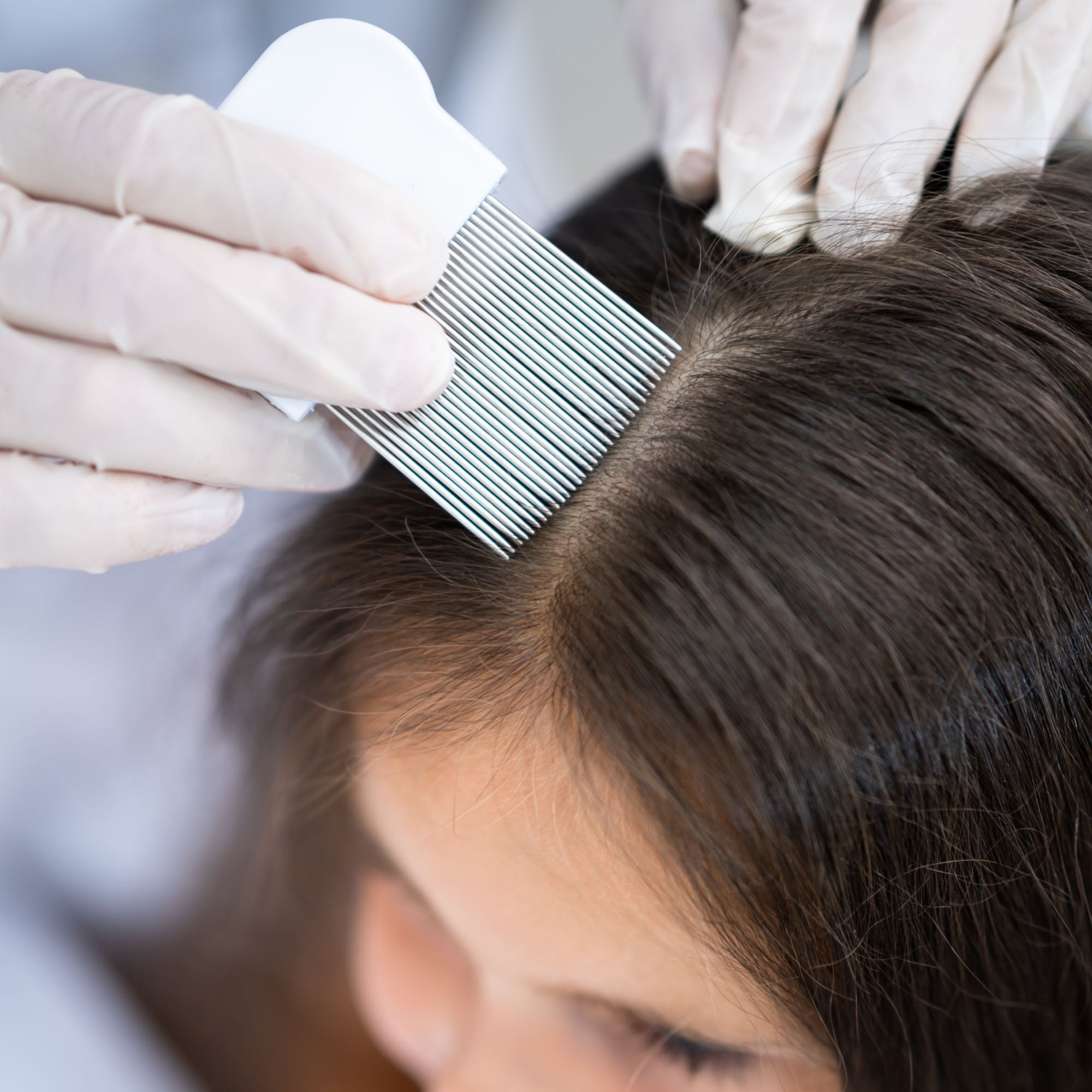 condition_image_hairlice_e576c977-a8ca-4977-8229-b872b658e641.jpg